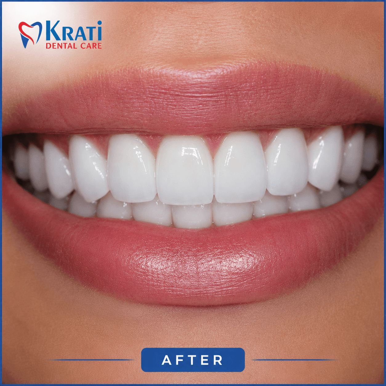 Priya Sharma — smile after treatment